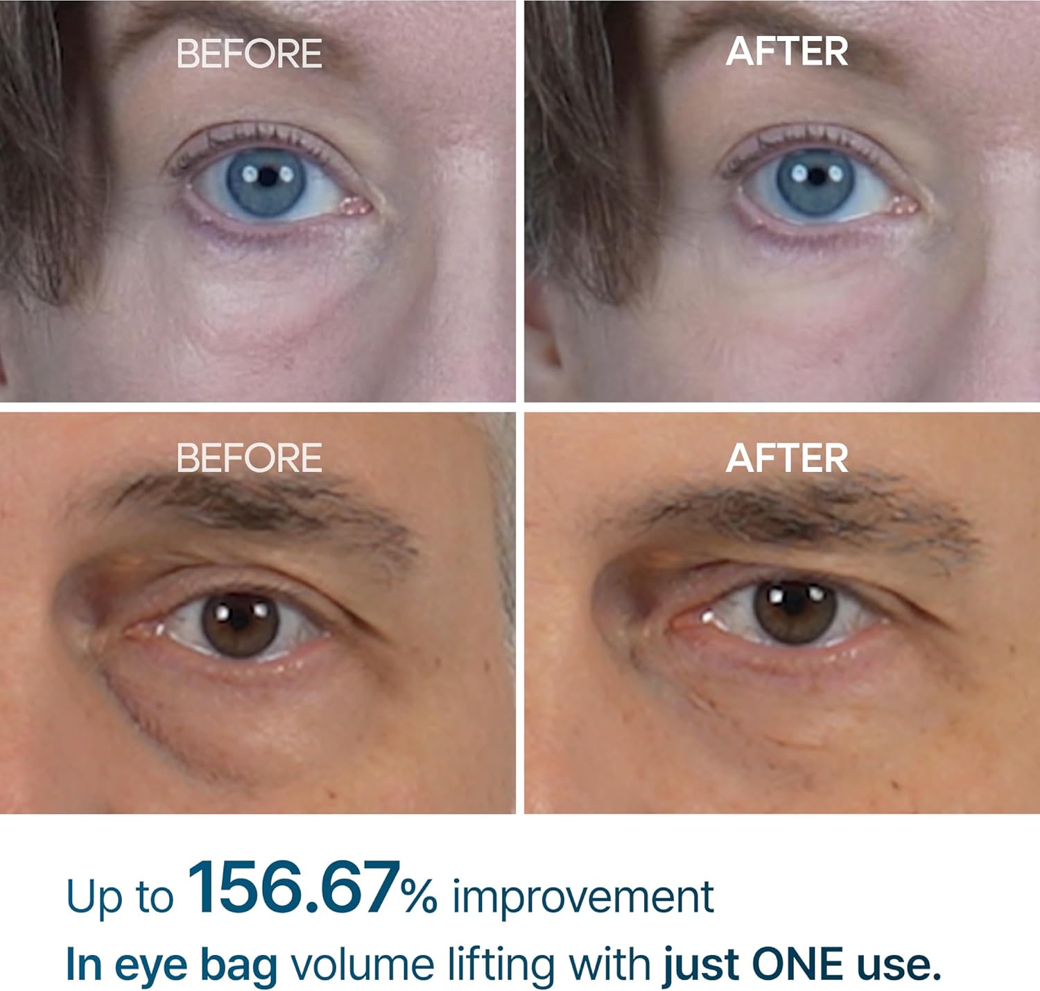 Dr. Melaxin Eyebag Cream - Best Dark Circle & Under Eye Bag Remover | UAE